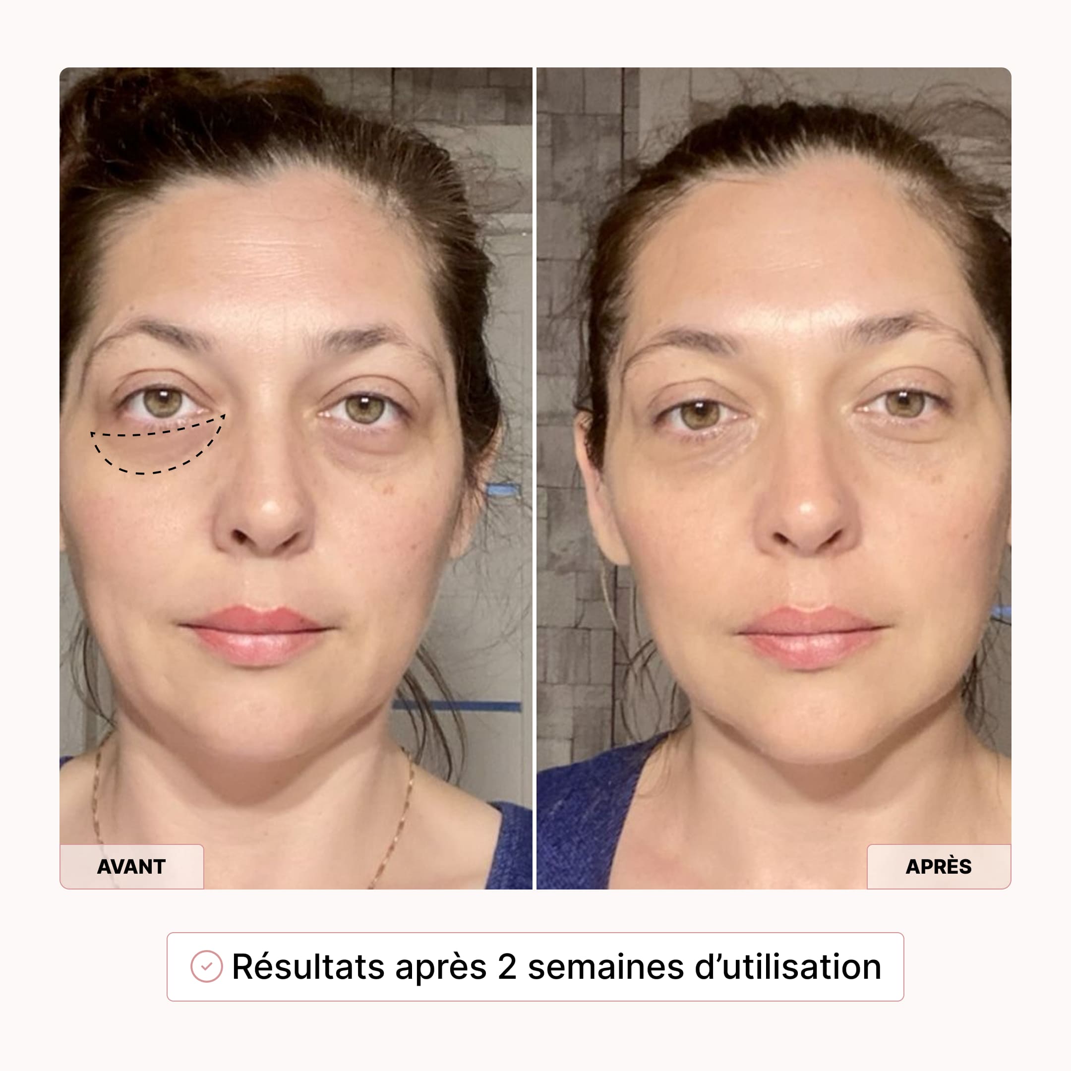 Protocole Regard 4-en-1 Baia® Stylo LED & Sérum Activateur
