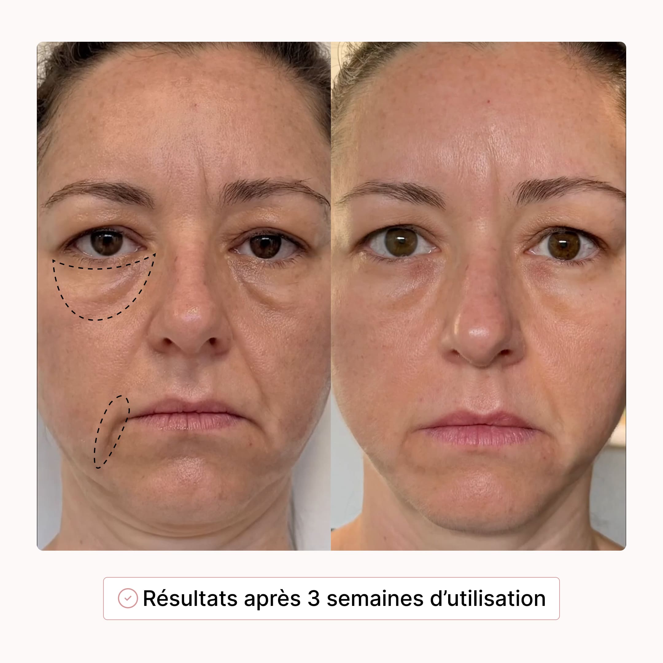 Soin Complet du Regard : Stylo & Sérum Activateur